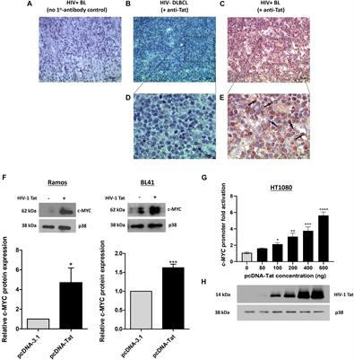 HIV-1 Transactivator of Transcription (Tat) Co-operates With AP-1 Factors to Enhance c-MYC Transcription